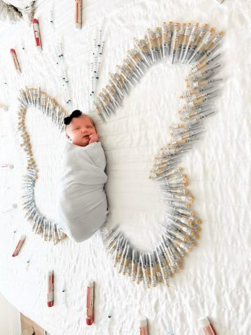 IVF Treatment