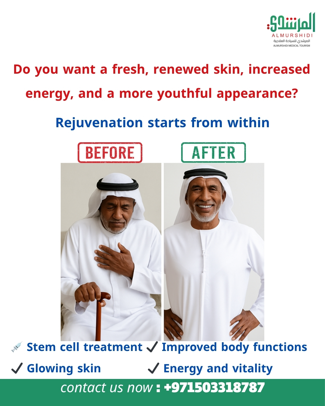 Stem Cell Therapy