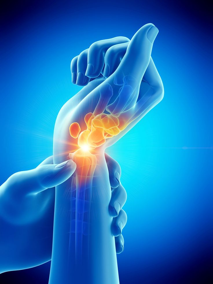 Wrist Joint Treatment