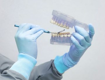 Dental Implants