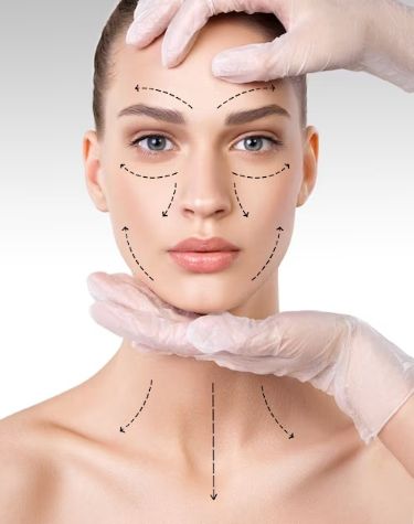 Facelift and Neck Lift