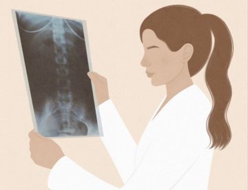 Back Pain and Spine Disorders