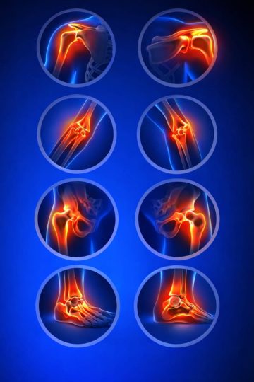 Joint Pain