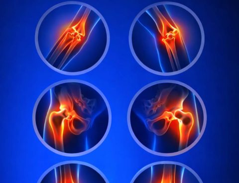 Joint Pain