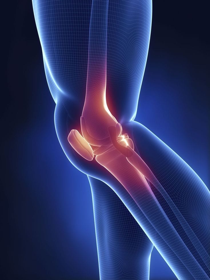 Knee Osteoarthritis