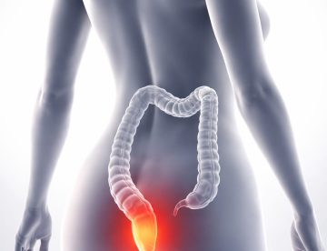 Hemorrhoids Treatment