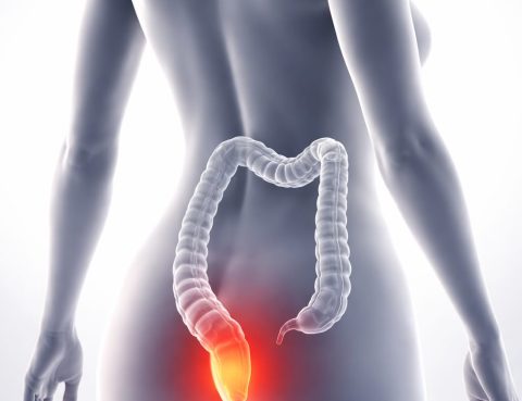 Hemorrhoids Treatment