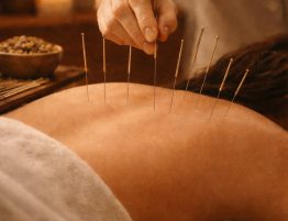 Acupuncture