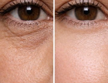 the Brightness of Your Eyes