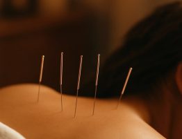 Acupuncture