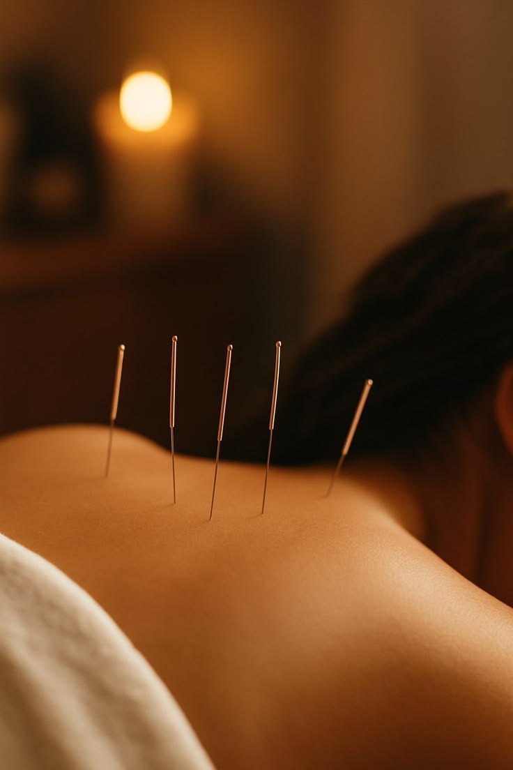 Acupuncture